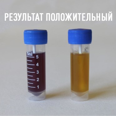 Петритест смыв на колиформные бактерии (БГКП), тупфер на крышке, 12 тестов